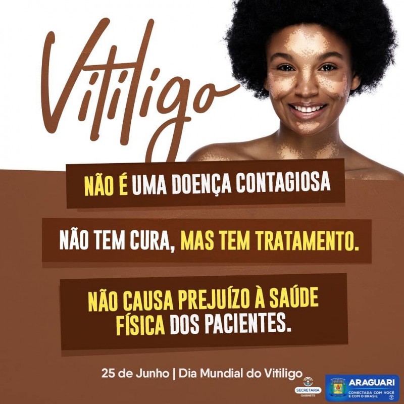 Dia Mundial do Vitiligo 25 Junho