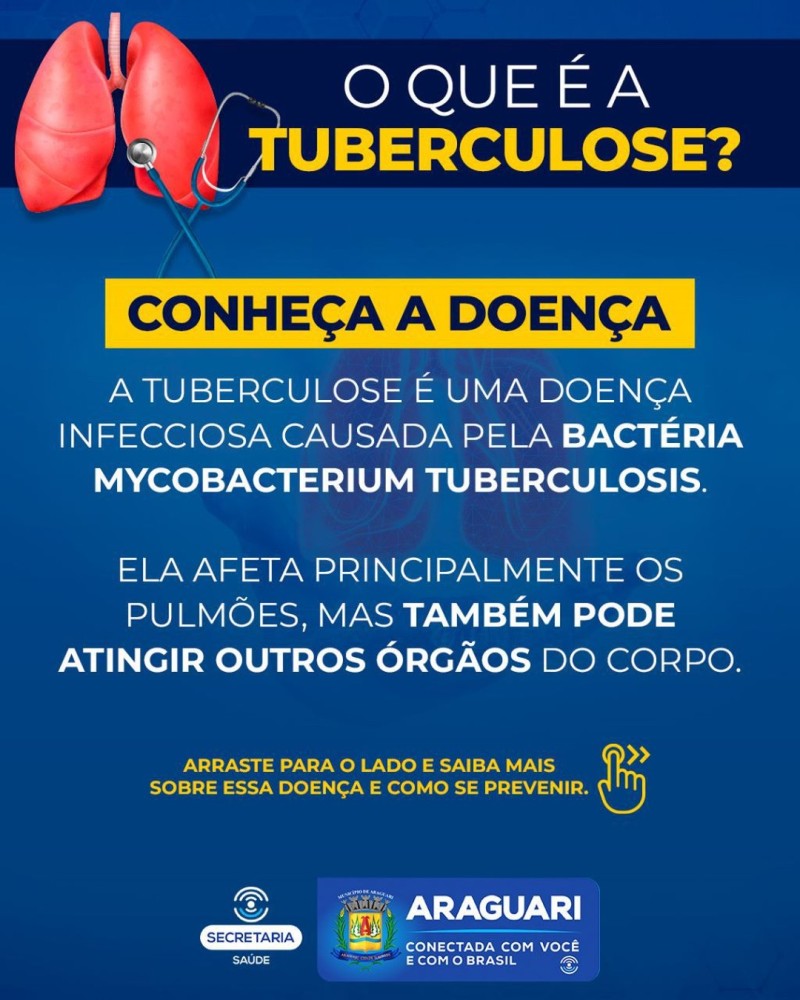 Prefeitura de Araguari promove ação de conscientização e prevenção à Tuberculose