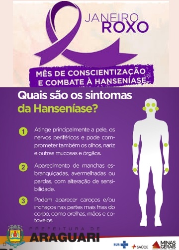 A Secretaria Municipal de Saúde de Araguari através do Departamento de Epidemiologia e Atenção Primária, em parceria com as Unidades de Saúde, Policlínica e Saúde Mental vem por meio deste, informar a população sobre a promoção de ações de divulgação sobre o Janeiro Roxo – Campanha mundial de conscientização sobre a Hanseníase.